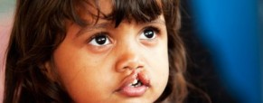 Operation Smile Operation Smile